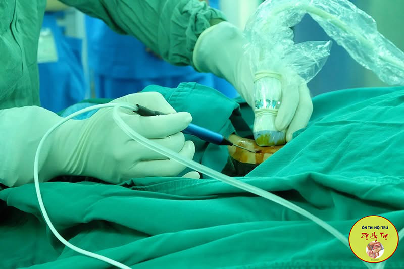 BIẾN CHỨNG KHI ĐỐT SÓNG CAO TẦN TUYẾN GIÁP
