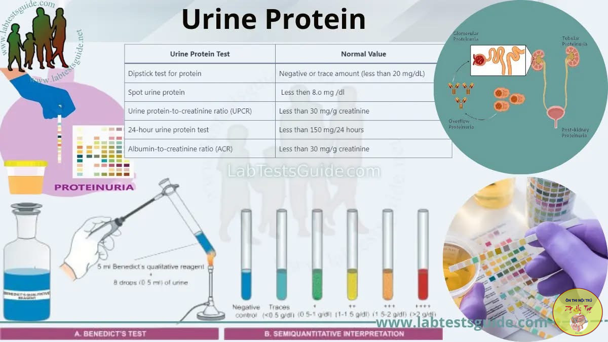 PROTEIN