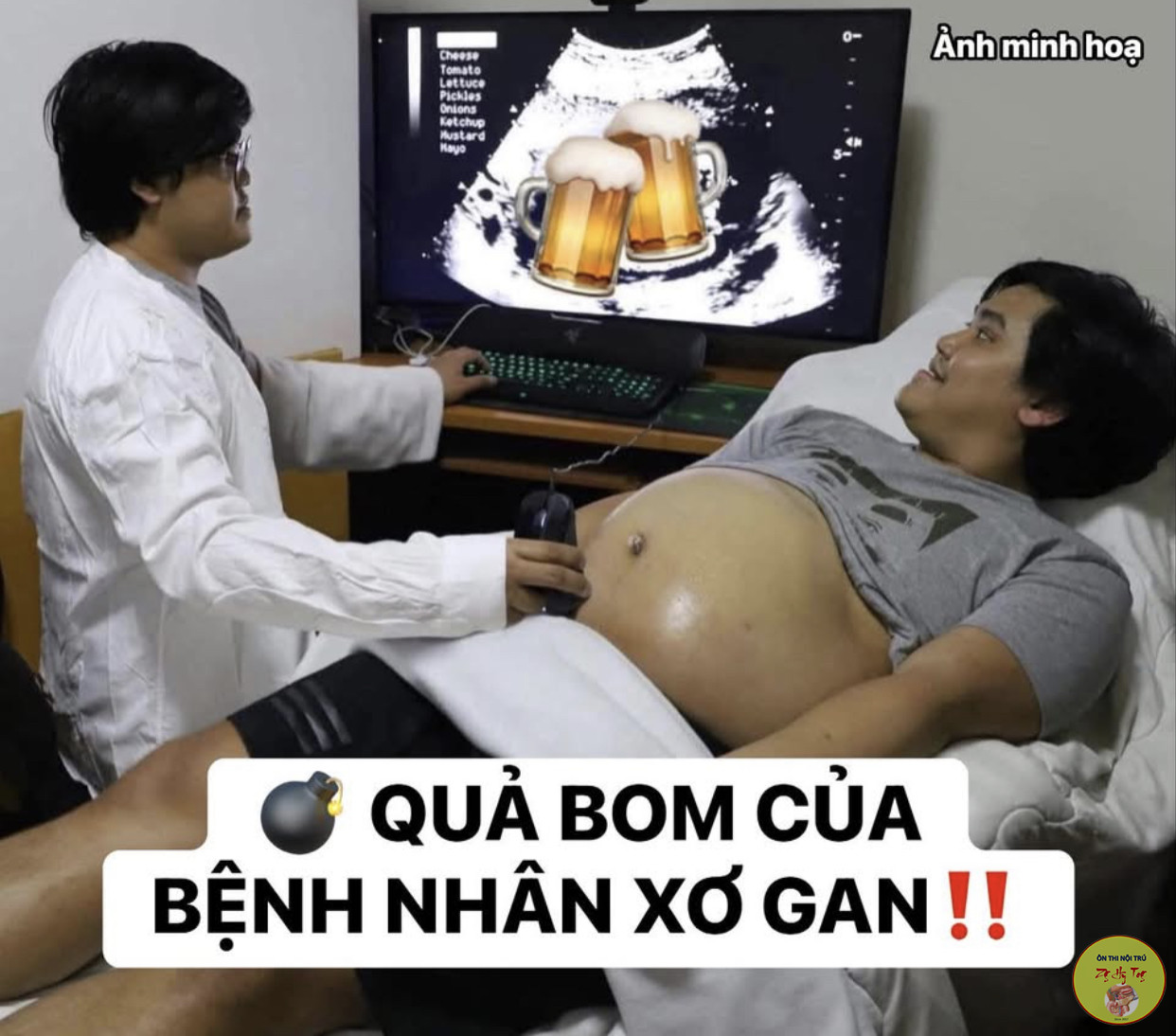 XƠ