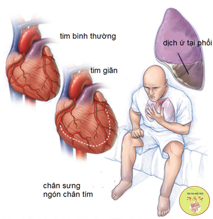 VIẾT VĂN APTIS B2