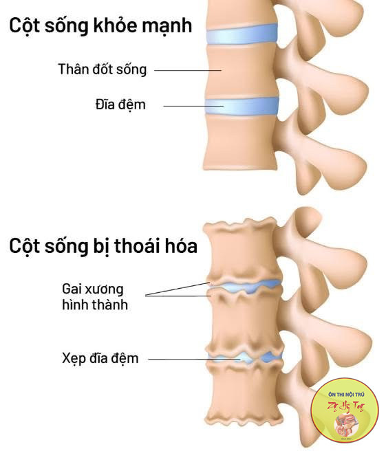CÁC