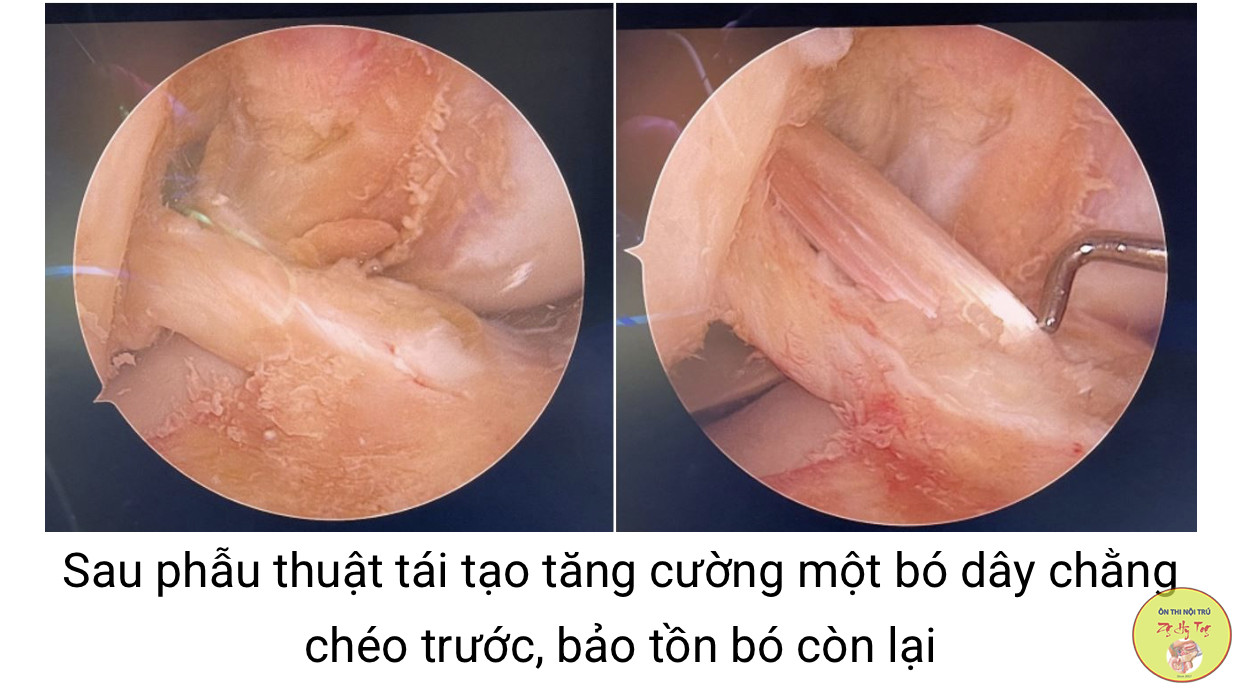 Đứt