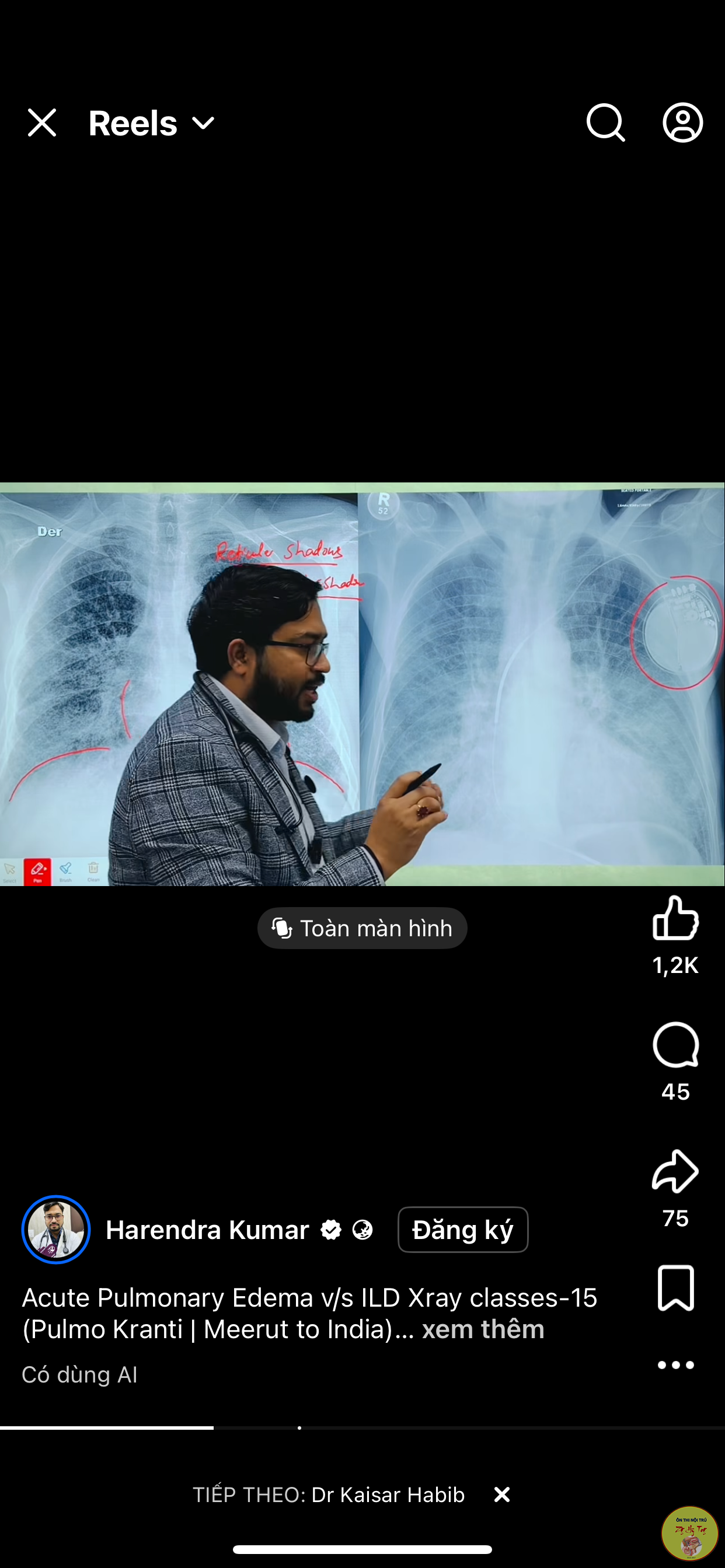 SINH THIẾT LÕI CÓ LÀM UNG THƯ LAM RỘNG KHÔNG