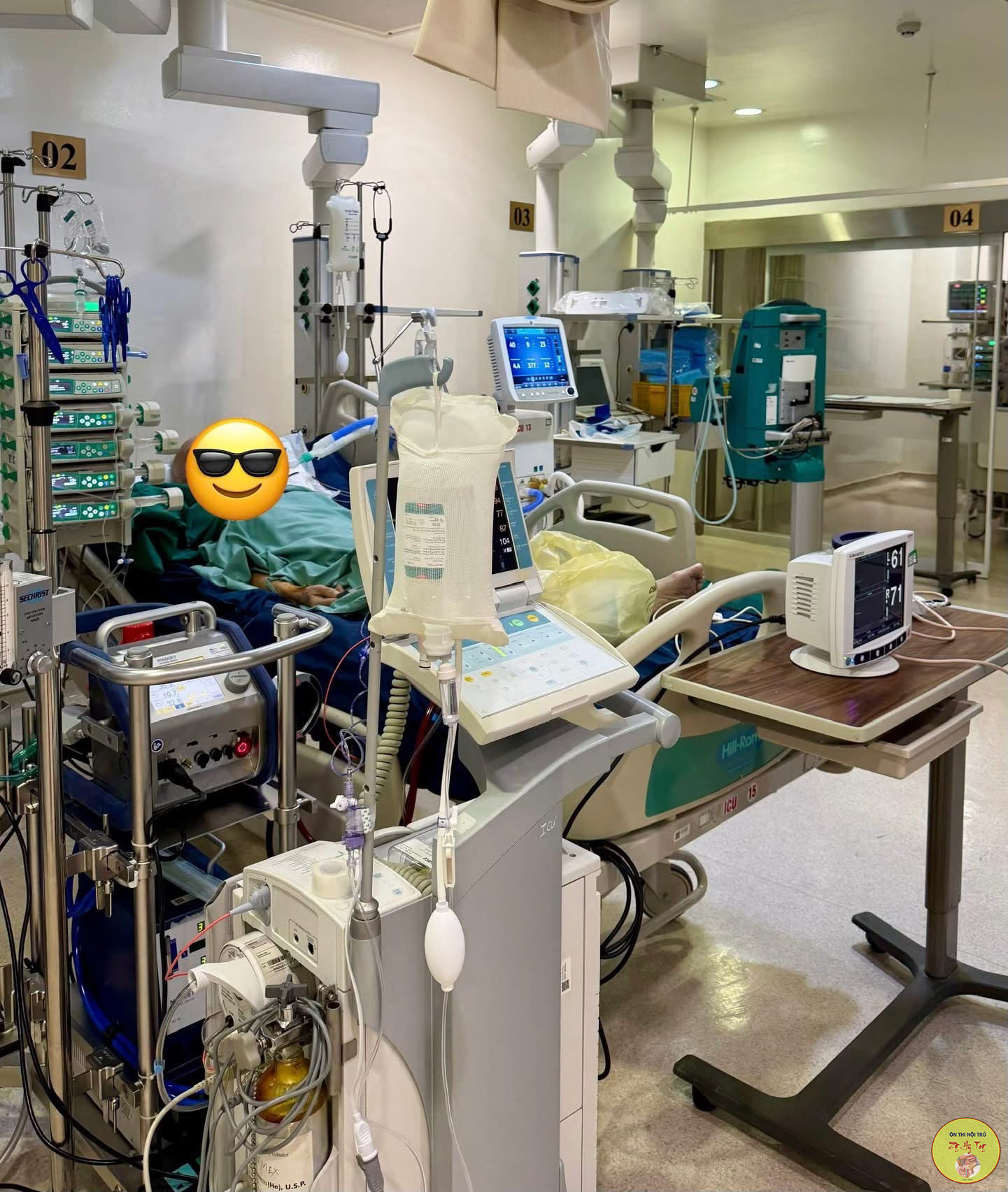 ECMO