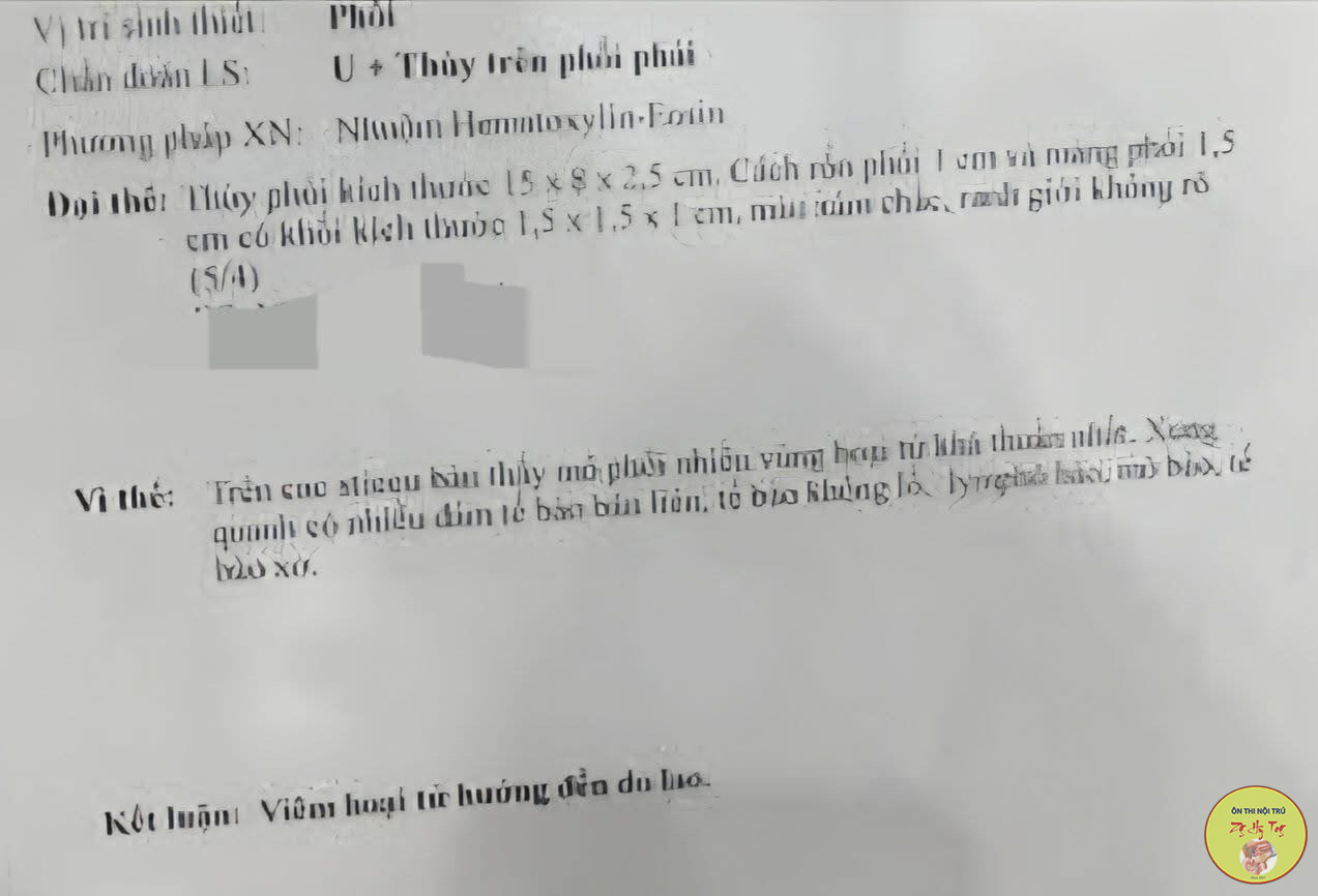 TỔN