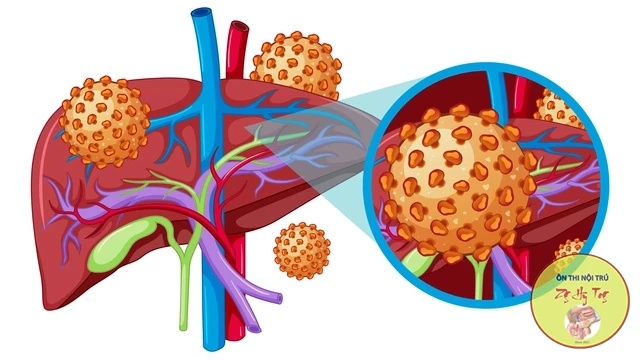 CƠ CHẾ  THUỐC KHÁNG VIRUS ĐIỀU TRỊ VIÊM GAN B