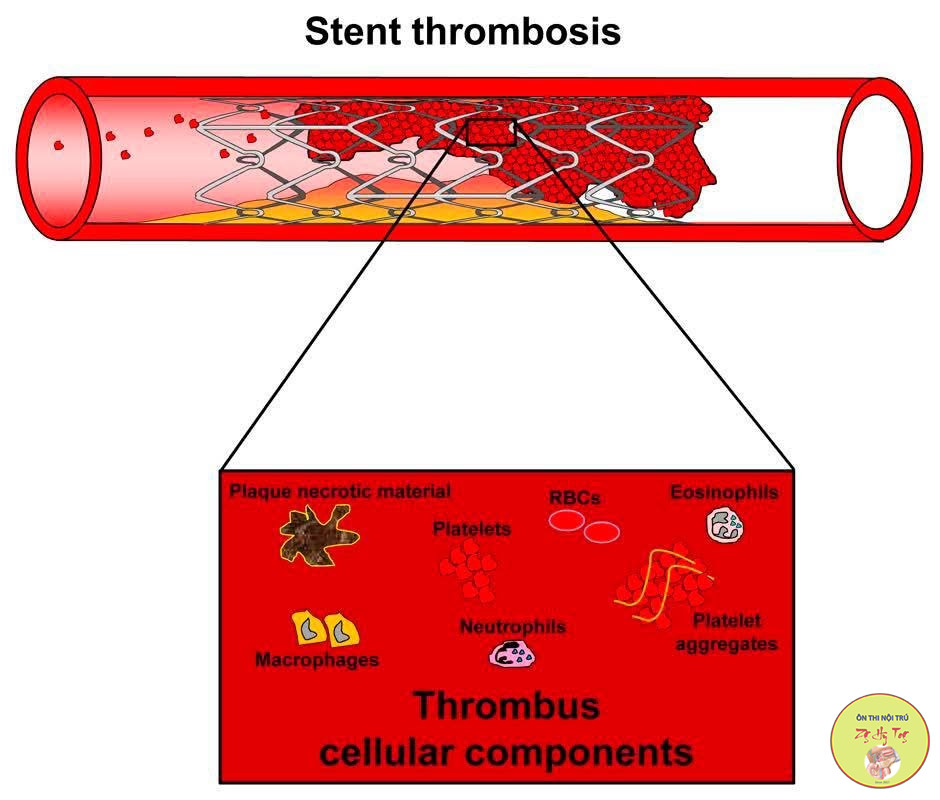 THALASEMIA